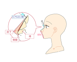 ヒアルロン酸に向いてる部位